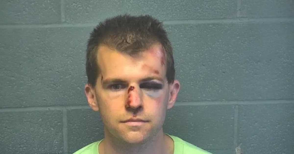Dad Cracks Eye Socket of Alleged Pedophile He Caught Touching Boy, 9, at Bus Stop