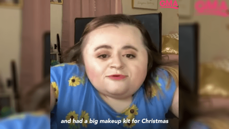 Influencer Is Using Her Disability to Make a Difference in the Beauty Industry