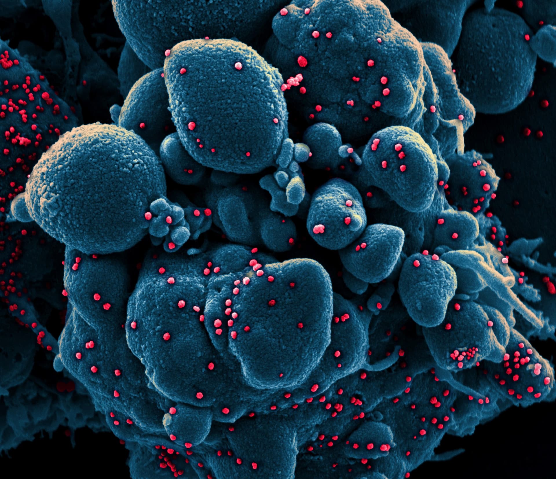 US Intelligence Confirms It Is Investigating the Origins of the Coronavirus