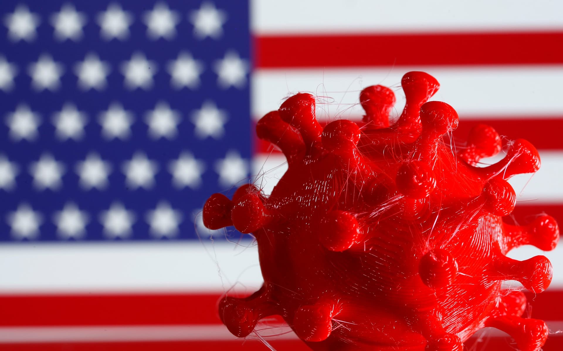 When the US Sneezes, the World Catches a Cold. What Happens When It Has Severe COVID-19?