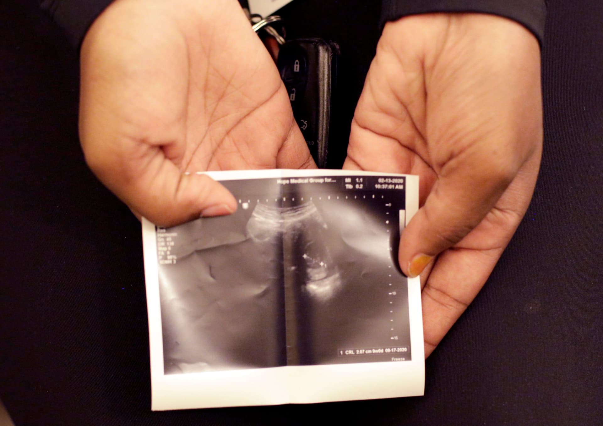 ‘Strongest Pro-Life Law in America’ Goes Into Effect in Texas