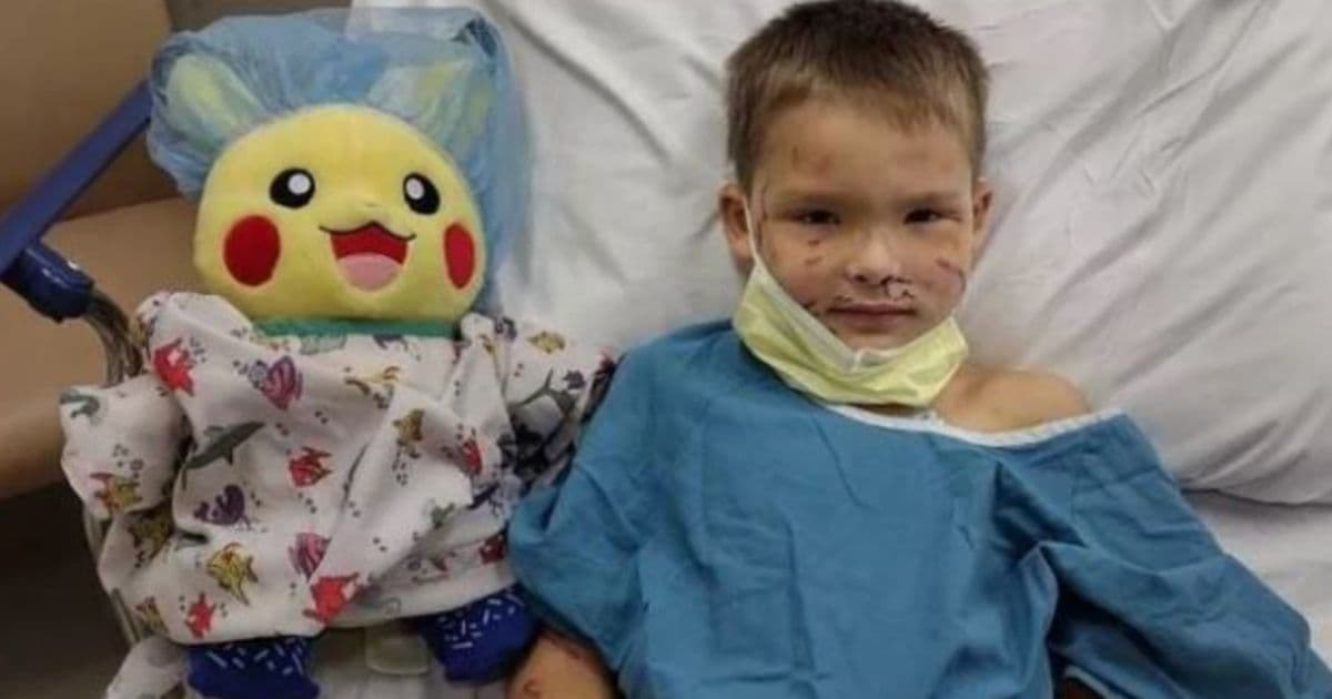 After Boy Survives Brutal Dog Mauling, Police Promise to Throw Him the 'Best Christmas Ever'