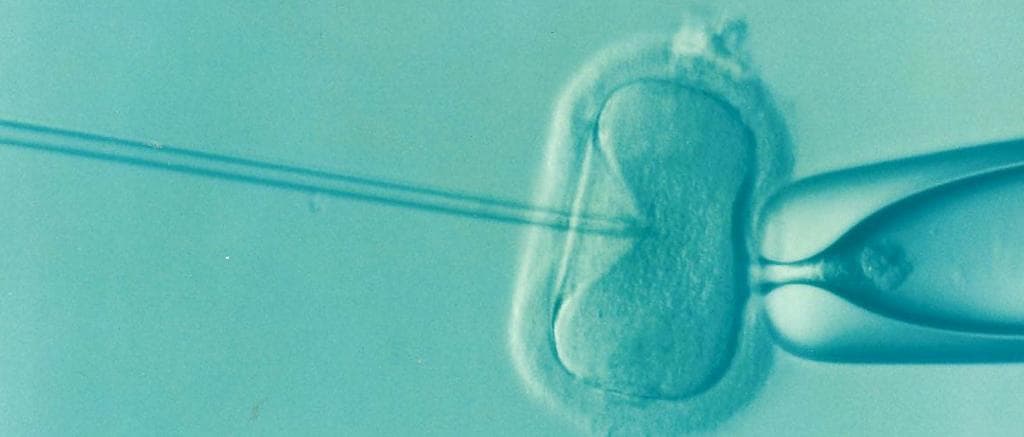 âYou Can Even Name Your Embryoâ: Genetics Startup Sells Test To Rank Embryos By IQ, Height And Looks