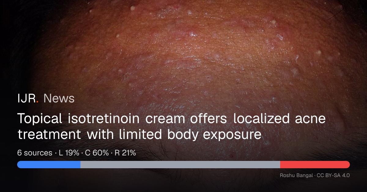Topical isotretinoin cream offers localized acne treatment with limited ...