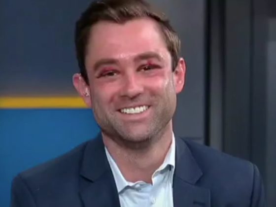 Fox News weatherman Adam Klotz appeared on "Fox and Friends" on Monday morning to discuss the attack he experienced on a New York City Subway.