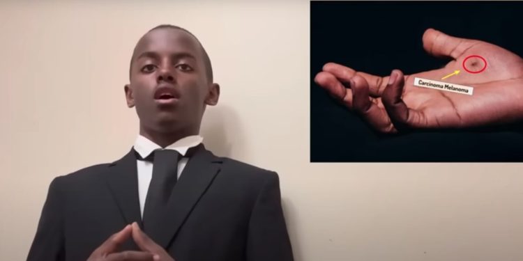 14-Year-Old Develops Skin Cancer Soap Cure and Wins Top Science Award