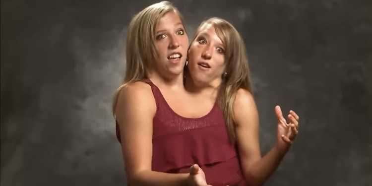 Conjoined Twin Abby Hensel Married in 2021