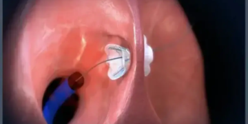 Johnson & Johnson Acquires V-Wave For $1.7 Billion To Boost Heart Failure Treatment Portfolio‌
‌