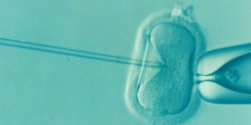 ‘You Can Even Name Your Embryo’: Genetics Startup Sells Test To Rank Embryos By IQ, Height And Looks