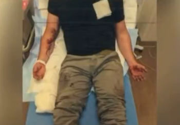 Agent’s Past Ordeal Resurfaces After Minneapolis ICE Shooting