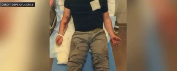 Agent’s Past Ordeal Resurfaces After Minneapolis ICE Shooting