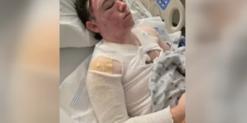 Worker Burned by Boiling Oil in Shocking Fast-Food Attack