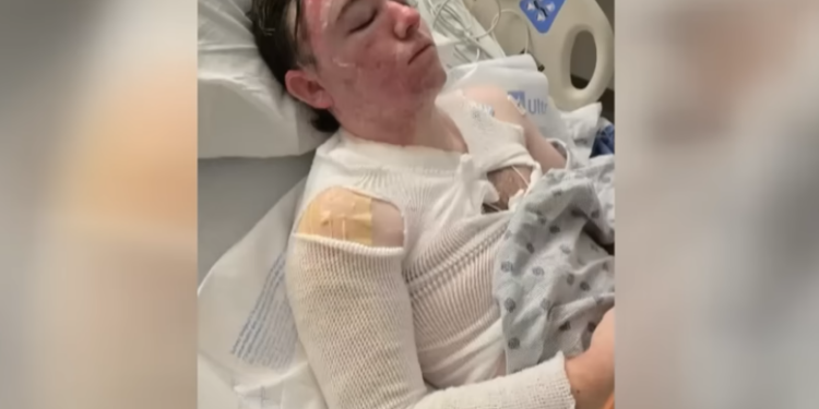 Worker Burned by Boiling Oil in Shocking Fast-Food Attack